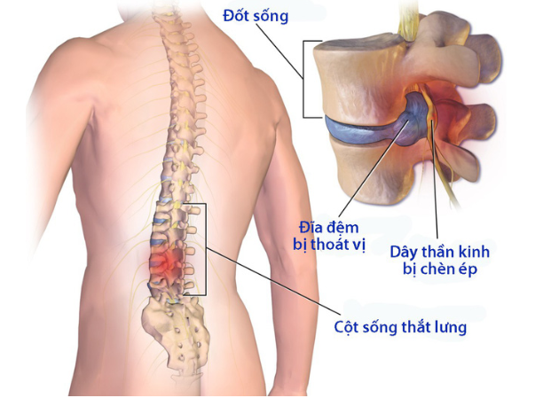 Những dấu hiệu và biểu hiện xét nghiệm xương khớp mà bạn cần lưu ý