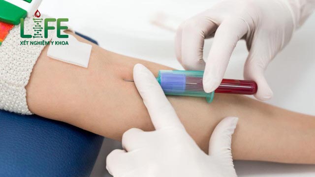 Uống kháng sinh có ảnh hưởng tới kết quả xét nghiệm máu không?