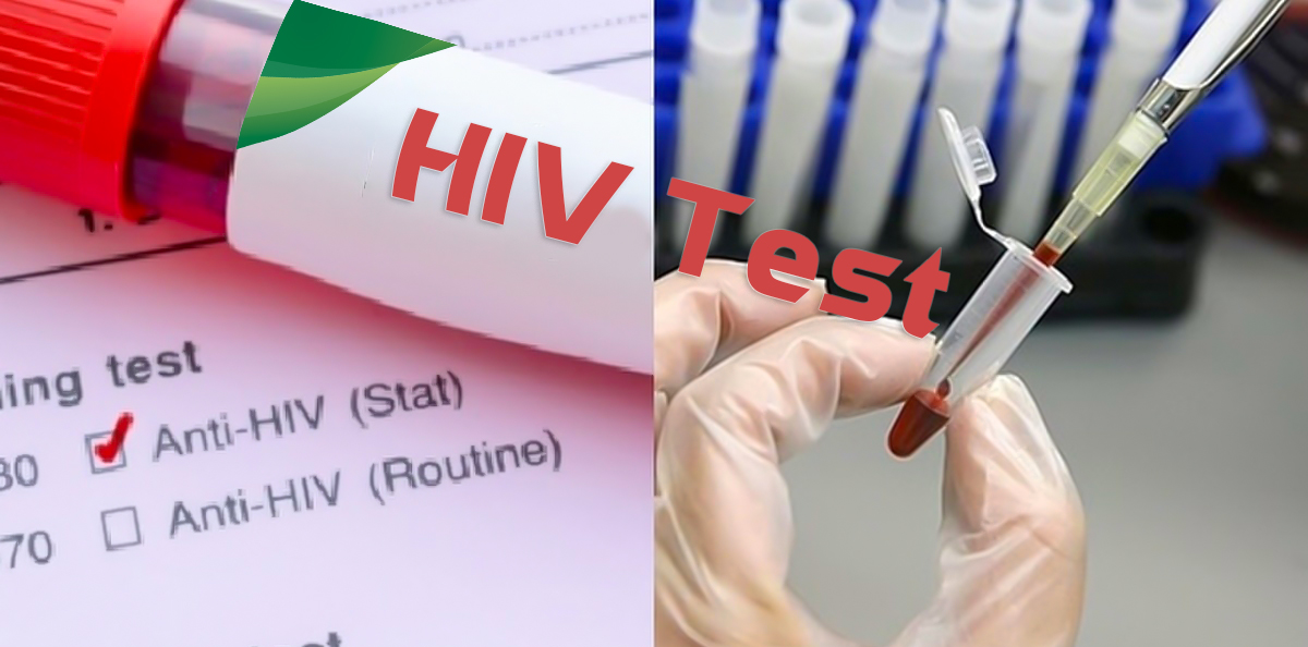 Những dấu hiệu của bệnh hiv/aids mà bạn cần phải lưu ý