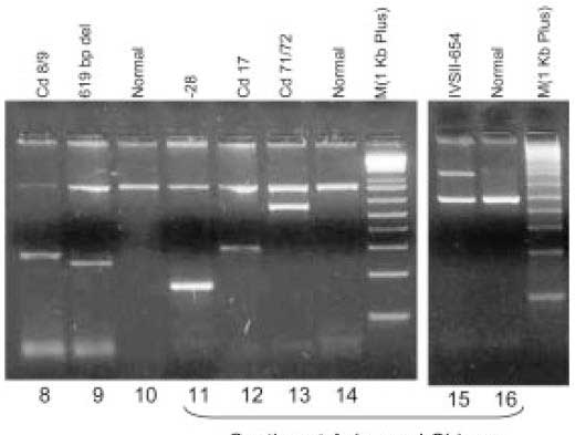 phuong-phap-Mutiplex-ARMS-PCR-va-ARMS-PCR