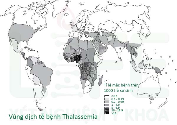 vung-dich-te-benh-thalassemia